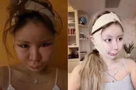 Chi 14 tỷ cho 200 ca PTTM, cô gái hối hận nhìn lại quá khứ