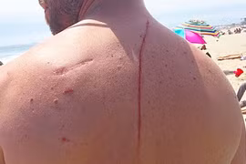 Kỳ lạ: Nếu không nhờ cá mập cắn, anh chàng này đã mất mạng