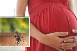 Phát hiện 83 người ở TP HCM nhiễm Zika