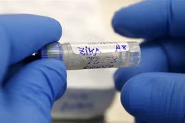 Danh sách 30 bệnh viện xét nghiệm Zika miễn phí tại TPHCM