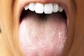 Dấu hiệu thấy bằng mắt thường chứng tỏ cơ thể cần thải độc