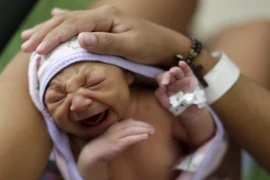 Zika có thể gây gây tổn thương hệ thần kinh trung ương