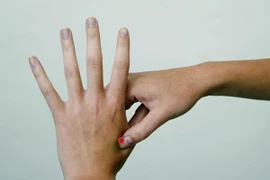 7 điểm huyệt giúp bạn giảm đau đầu ngay tức khắc