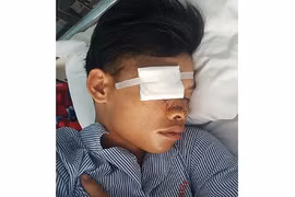 Quảng Bình: “Hổ báo” với đàn anh, trai làng bị chém gục tại quán nước