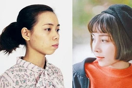 Bị chê "xấu như vượn", cô gái Thái Nguyên quyết phẫu thuật