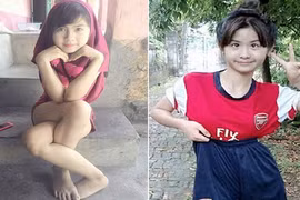 Chẳng cần gợi cảm, cô gái chân khoèo vẫn dẫn đầu Miss Teen