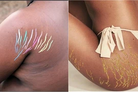 Chị em thích thú trào lưu hô biến vết rạn trên cơ thể