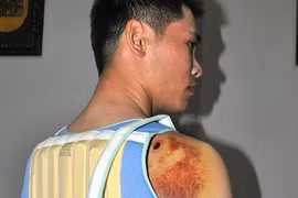 Bênh cha, "quý tử" của bí thư xã bắn người trọng thương