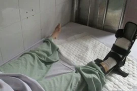 Truy tìm tài xế ô tô cán nát bàn chân nữ sinh viên