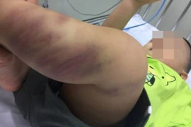 Hãi hùng loạt vụ bạo hành trẻ em tàn bạo giữa Thủ đô