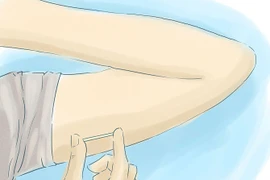 8 điều cần biết về que cấy tránh thai dưới da