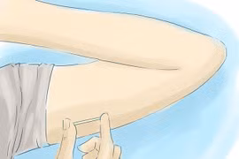 8 điều cần biết về que cấy tránh thai dưới da