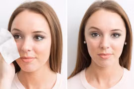 Sai lầm khi làm sạch da mặt khiến mụn mãi không khỏi