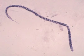 10 loại ký sinh trùng trong mắt có thể gây mù