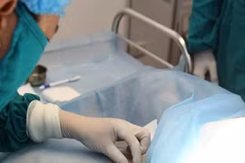 Những sự thật cần biết khi muốn tiêm botox trị hôi nách