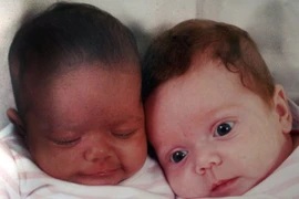 Kỳ lạ những ca sinh đôi nhưng mỗi con một bố 