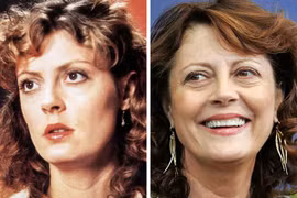 Sự thật về 10 bộ phận khiến bạn trông già nua hơn cả nếp nhăn