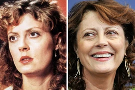 Sự thật về 10 bộ phận khiến bạn trông già nua hơn cả nếp nhăn