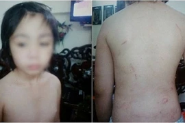 Chủ tịch Hà Nội chỉ đạo khẩn trương điều tra vụ bé trai bị bạo hành 