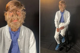 "Người sói" Ấn Độ ghi danh vào Kỷ lục Thế giới