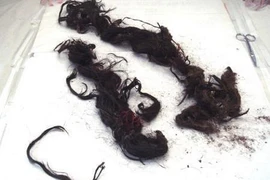 Bật nắp quan tài, phát hiện nguyên nhân hoàng đế Quang Tự đột tử