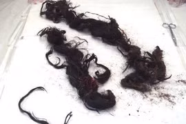 Bật nắp quan tài, phát hiện nguyên nhân hoàng đế Quang Tự đột tử