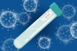 Có thêm máy phát hiện biến chủng nguy hiểm SARS-CoV-2 qua nước bọt