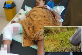 Sống sót thần kỳ sau khị bị cá sấu kéo xuống đầm lầy