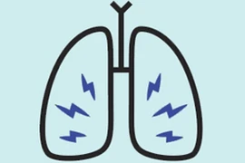 9 dấu hiệu của bệnh ung thư phổi bạn cần lưu ý