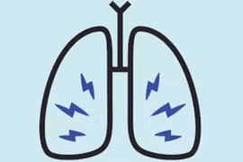 9 dấu hiệu của bệnh ung thư phổi bạn cần lưu ý