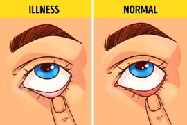 Những cách tự kiểm tra sức khỏe tại nhà để đoán nguy cơ phát triển bệnh