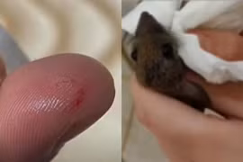 Bị chuột cắn, nữ sinh cắn lại để trả thù gây choáng