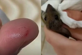 Bị chuột cắn, nữ sinh cắn lại để trả thù gây choáng