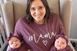 Kỳ lạ cặp song sinh nhưng lại cùng cha khác mẹ