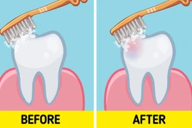 Nha sĩ bật mí thắc mắc nên đánh răng trước hay sau khi ăn sáng