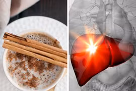 8 siêu thực phẩm mà chúng ta không nên ăn quá nhiều