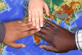 Kỳ lạ người đàn ông thay đổi màu da từ trắng sang nâu