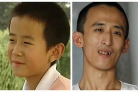Cựu thần đồng Trung Quốc từng đỗ đại học lúc mới 10 tuổi giờ thế nào?