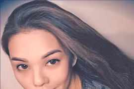 Cháu gái tỷ phú chết vì hút mỡ nâng ngực tại Hàn Quốc: Tai biến đáng sợ