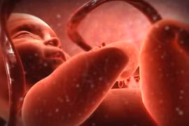 Sốc: Bé 1 tháng tuổi đã mắc giang mai... nguyên nhân, cách phòng ngừa?