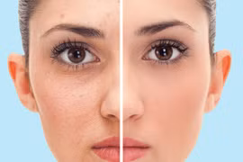 5 điều kỳ diệu xảy ra khi bạn tắm bằng nước lạnh