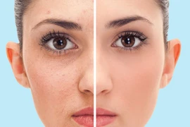 5 điều kỳ diệu xảy ra khi bạn tắm bằng nước lạnh