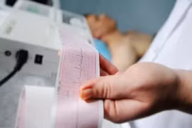 Chàng trai 23 tuổi chết vì nhồi máu cơ tim, bác sĩ chỉ ra nguyên nhân bất ngờ