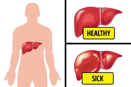 Chứng đầy hơi có thể là dấu hiệu 6 căn bệnh nguy hiểm cần cảnh giác