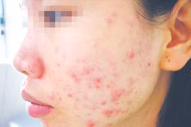 Sát Tết, chị em lại khốn đốn vì mỹ phẩm giả