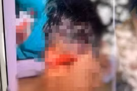 Thanh Hóa: Mang dao tới trường, chém trọng thương bạn cùng lớp