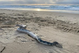 Người đàn ông suýt chết vì nuốt phải chìa khóa ô tô