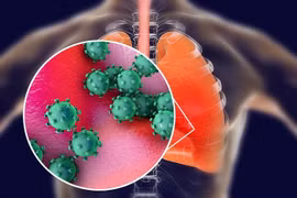 Căn bệnh COVID-19 tấn công cơ thể con người kinh khủng thế nào?