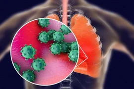 Căn bệnh COVID-19 tấn công cơ thể con người kinh khủng thế nào?