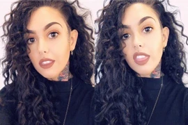 Cô gái gây sốc vì vòng một phẳng lỳ, nhiễm trùng sau nâng ngực